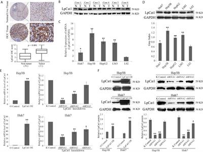 LpCat1 Promotes Malignant Transformation of Hepatocellular Carcinoma Cells by Directly Suppressing STAT1